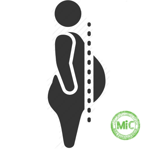 ابدومینوپلاستی