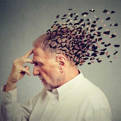 آلزایمر